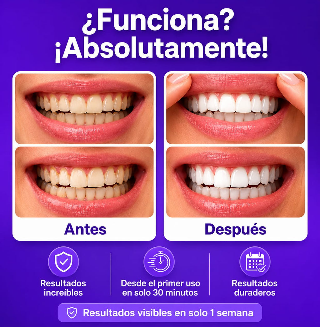 Tiras blanqueadoras dentales