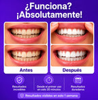 Tiras blanqueadoras dentales